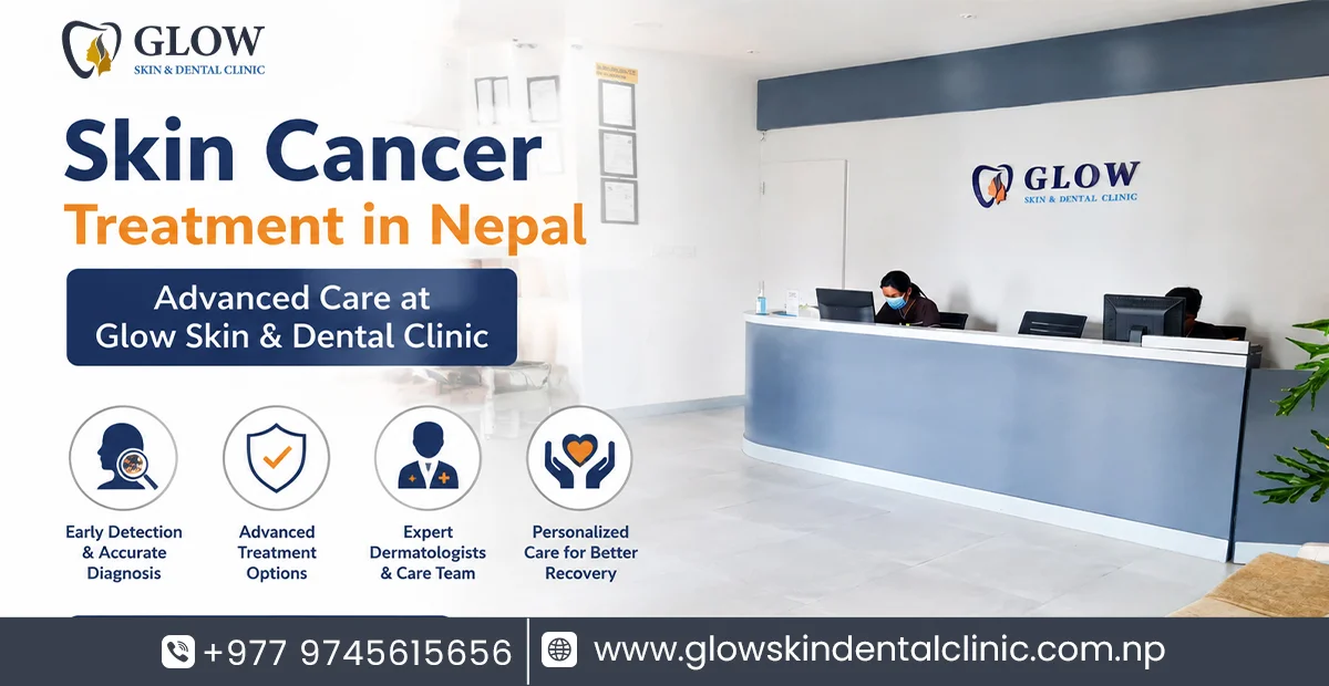 Skin Cancer Treatment in Nepal – Advanced Care at Glow Skin & Dental Clinic