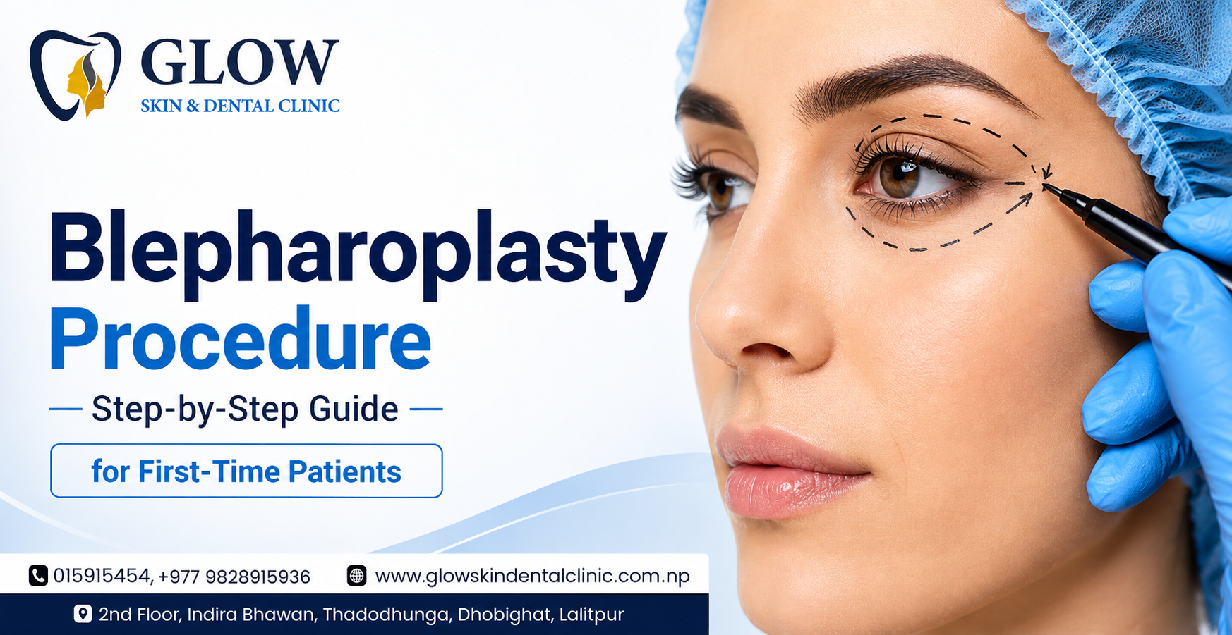 Blepharoplasty-Procedure-Step-by-Step-Guide-for-First-Time-Patients.png